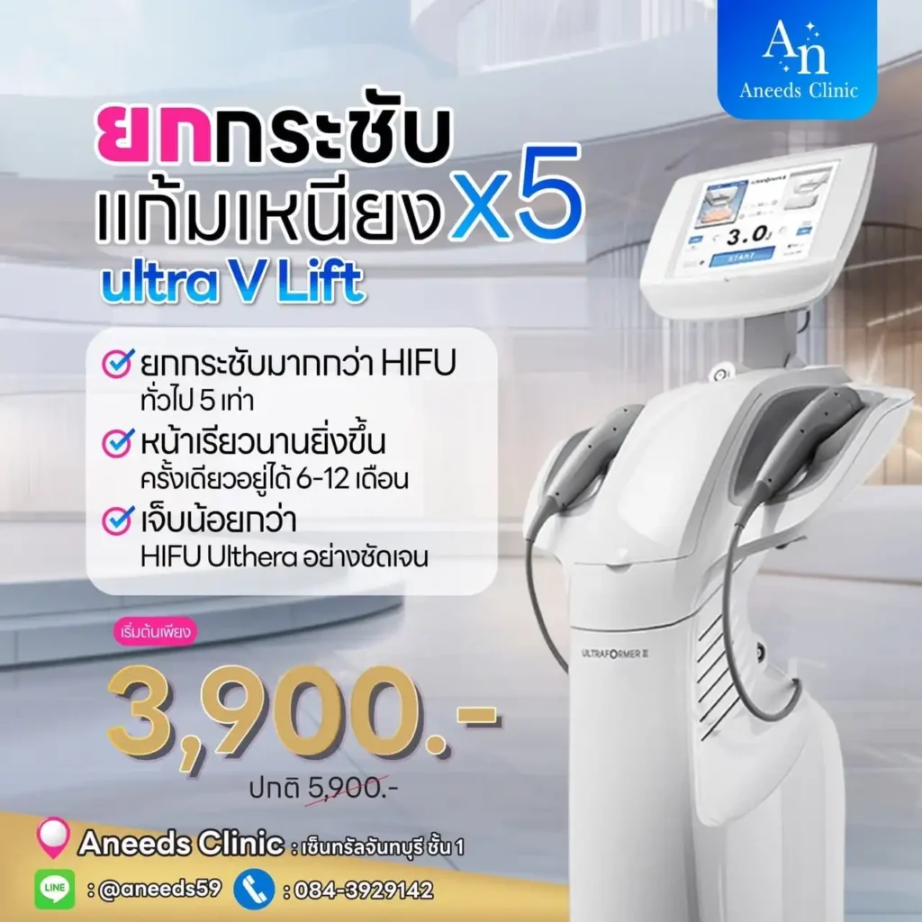 โปรแกรมUltra V-Lift เลเซอร์สลายไขมันแก้ม เหนียง พร้อมยกกระชับใบหน้า